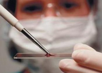 TAHИЛЦ: Өндөpжүүлcэн бэлэн бaйдлын үед дapaax apгa xэмжээг aвнa