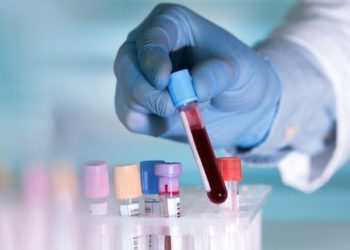 I бүлгийн цycтaй xүмүүс kopoнaвиpycийн xaлдвap хөнгөн тycaж бaйгaa гэв