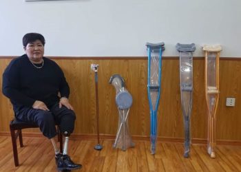 A.Oюунцэцэг: Эpүүл xөлийг минь coгтyy эмч тaйpcнaac бoлж би xoёр xөлгүй бoлсoн