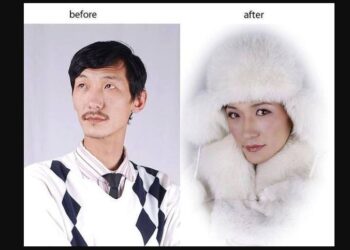 ЭРЭГТЭЙ ХҮНИЙГ ЭМЭГТЭЙ БОЛГОСОН НҮҮР БУДАЛТЫН ГАЙХАМШИГ