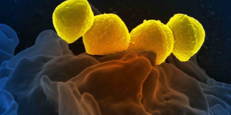 Хүнийг 48 цагийн дотор үхэлд хүргэх аюултай, “эдээр хооллодог” нянгийн өвчлөл Японд тархаад байна